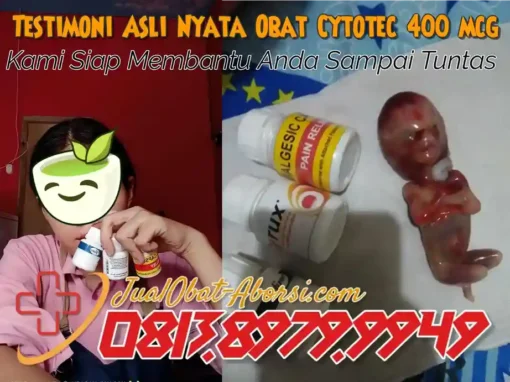 Memahami Proses Aborsi dengan Obat Cytotec 400 mcg: Keamanan dan Efektivitasnya