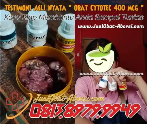 Memahami Proses Aborsi dengan Obat Cytotec 400 mcg: Keamanan dan Efektivitasnya