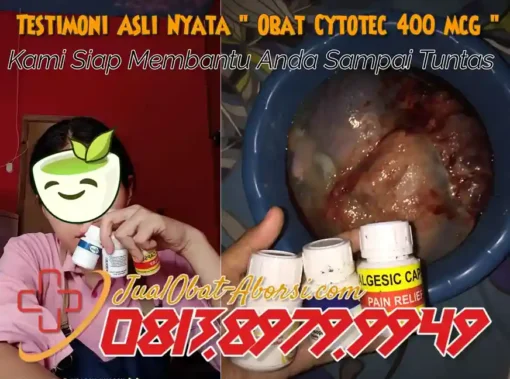 Memahami Proses Aborsi dengan Obat Cytotec 400 mcg: Keamanan dan Efektivitasnya